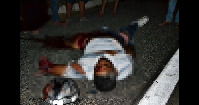 braço e perna decepados acidente jacobina do piauí