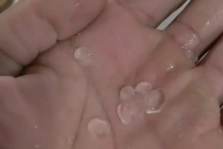 Temporal com granizo atinge Arraial e assusta moradores