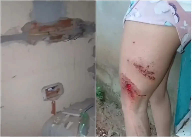 Mulher é atingida por raio e residência sofre danos em Buriti dos Lopes