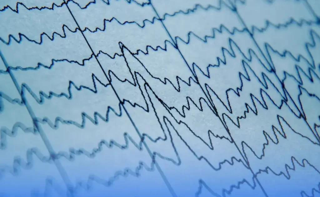 Gráfico de eletroencefalograma (EEG) com ondas cerebrais em papel azul claro, indicando atividade neural.