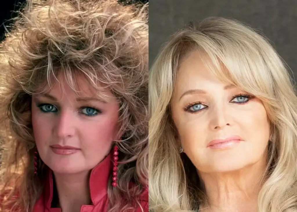 Bonnie tyler parada cardíaca: Bonnie T comparativo visual idade