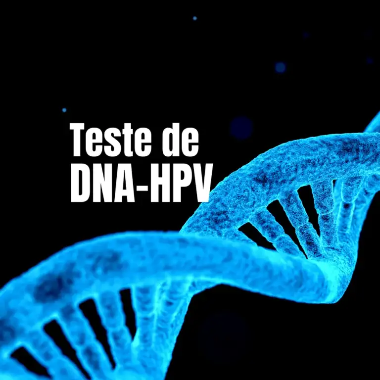 Teste dna hpv em amarante: Teste DNA HPV Amarante detecção câncer colo útero